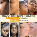 Anti-Unreinheiten-Maske mit Kurkuma