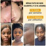 Anti-Unreinheiten-Maske mit Kurkuma